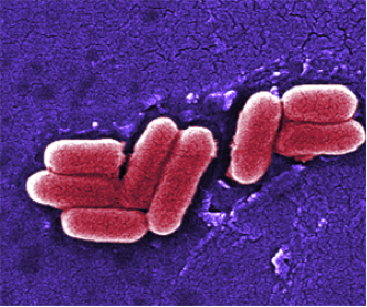 E coli